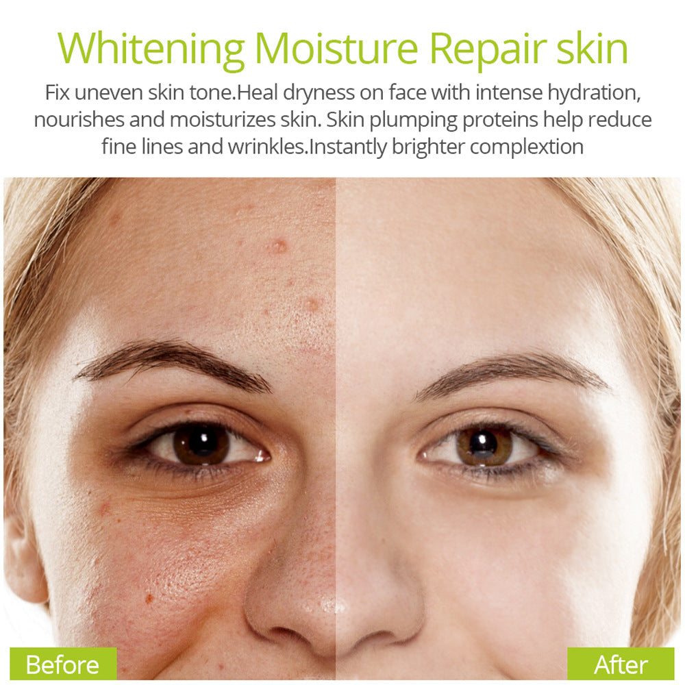 VIBRANT GLAMOUR Vitamin C Anti-acne Original Liquid Serum