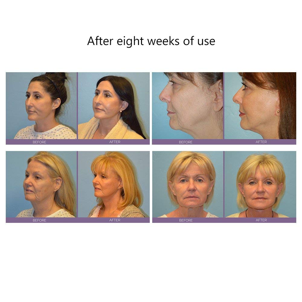 Face Lift Microcurrent Roller Massager