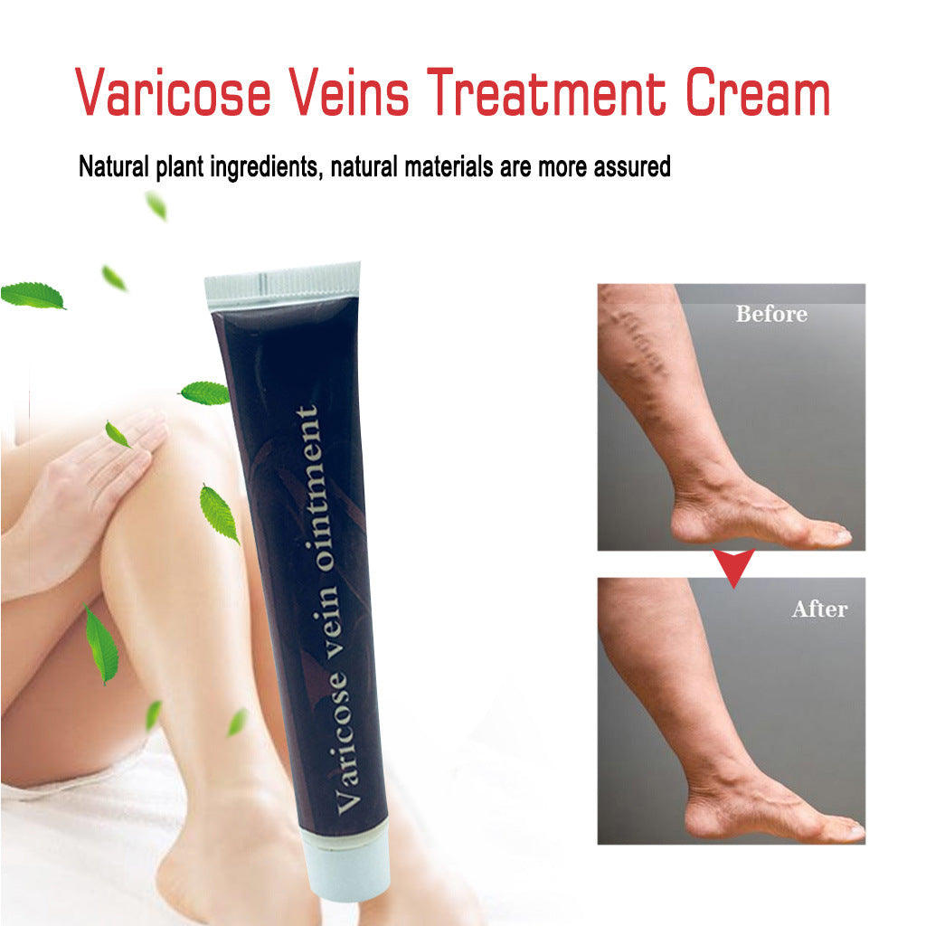 Body care Varicose flat ointment