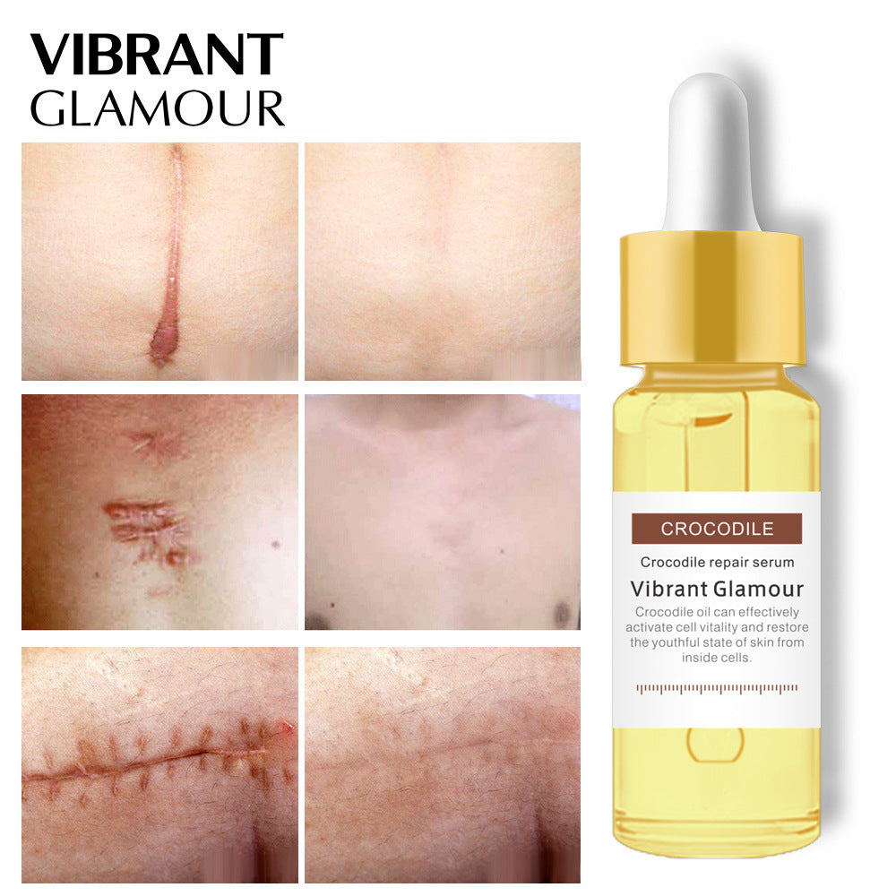 VIBRANT GLAMOUR Scar Repair Essence