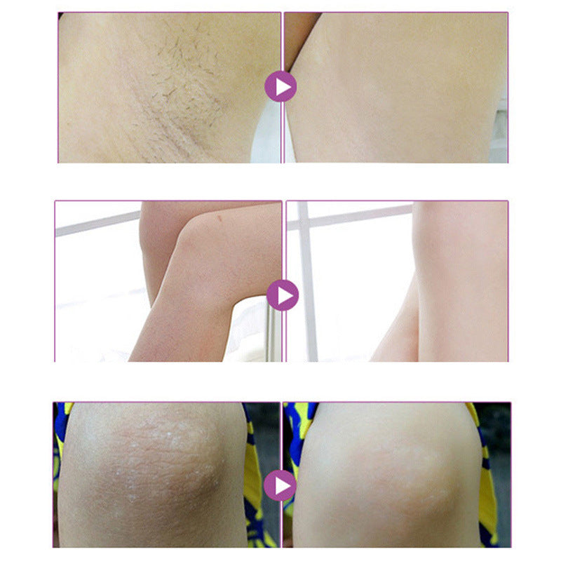 Aichun armpit diminishing melanin cream