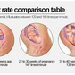 Home fetal pregnant women fetal heartbeat detection