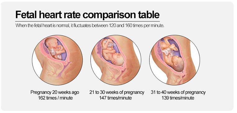 Home fetal pregnant women fetal heartbeat detection