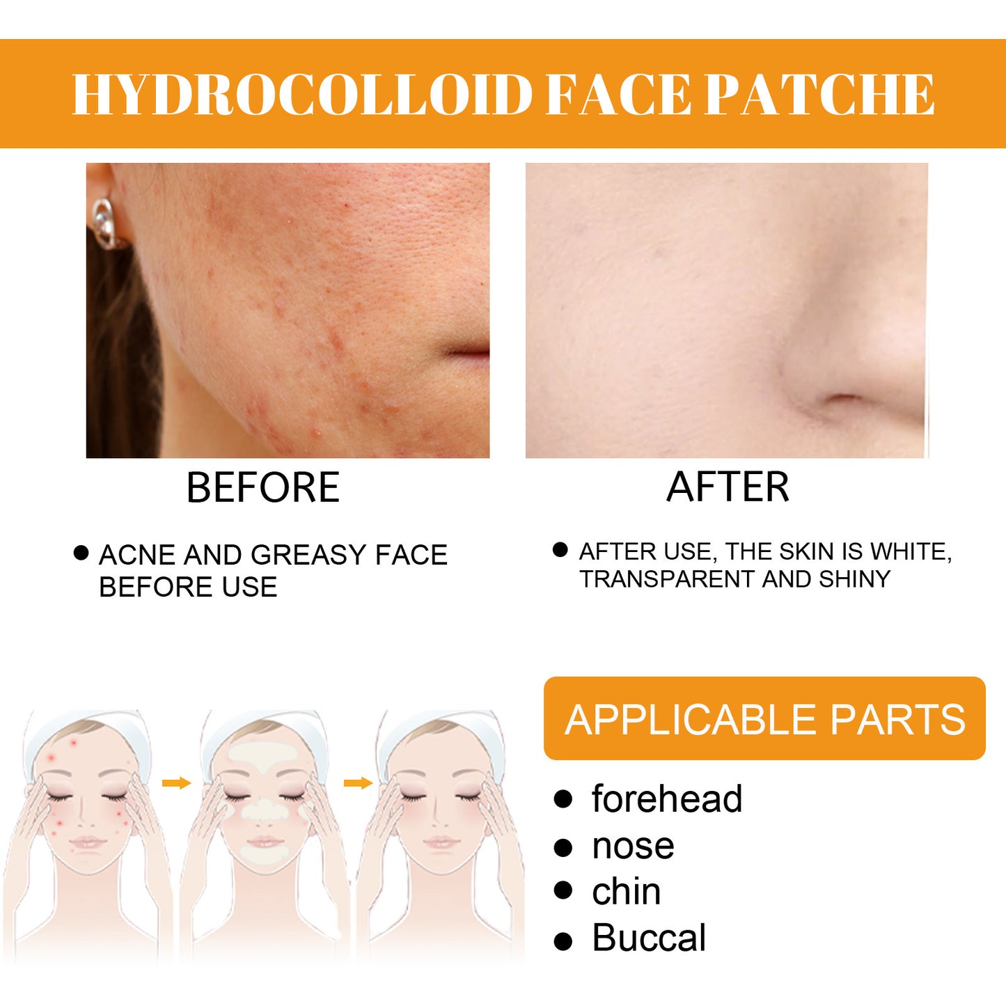 EELHOE Hydrogel Facial Acne Sticker