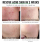VIBRANT GLAMOUR Tea Tree Acne Serum