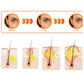 Acne Patch Skin Tags