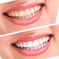 Top Quality 44%CP Teeth Whitening Kit