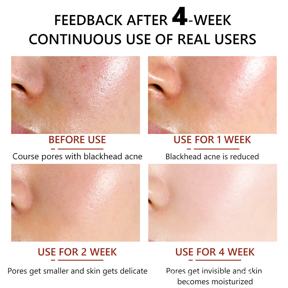 VIBRANT GLAMOUR Salicylic Acid Serum