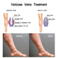 Body care Varicose flat ointment