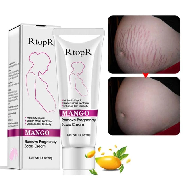 RtopR Mango Resistant Cream